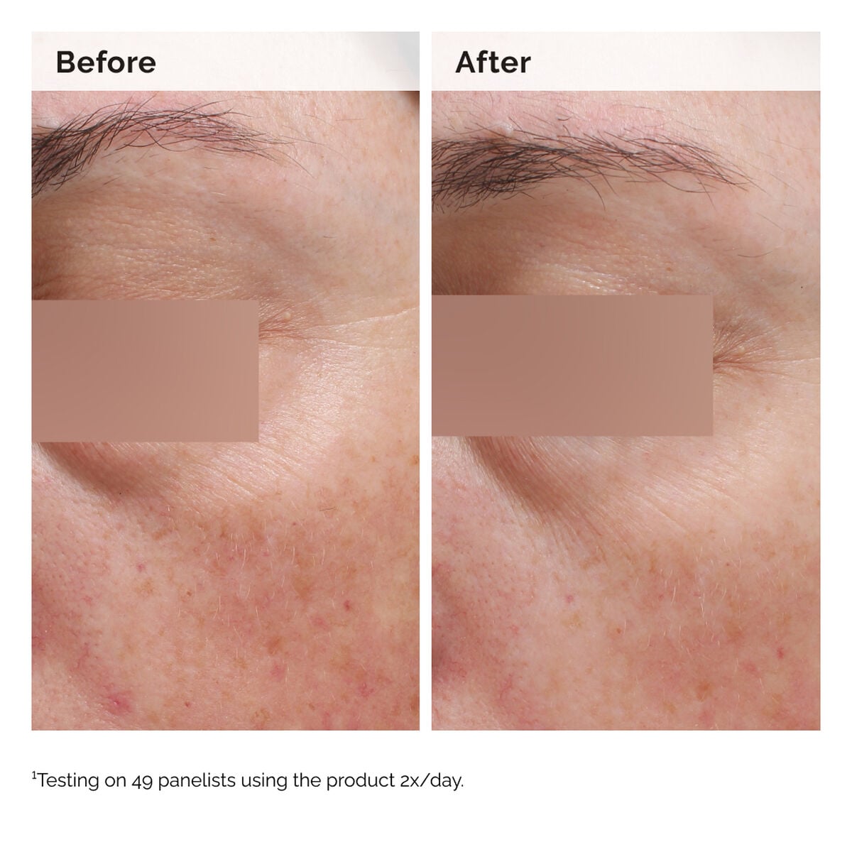 niacinamide-5-face-and-body-emulsion-z7 2024-08-23-ORD-Nia-5pct-Face-Body-B-A-Elasticity-Global-02-1x1.jpg