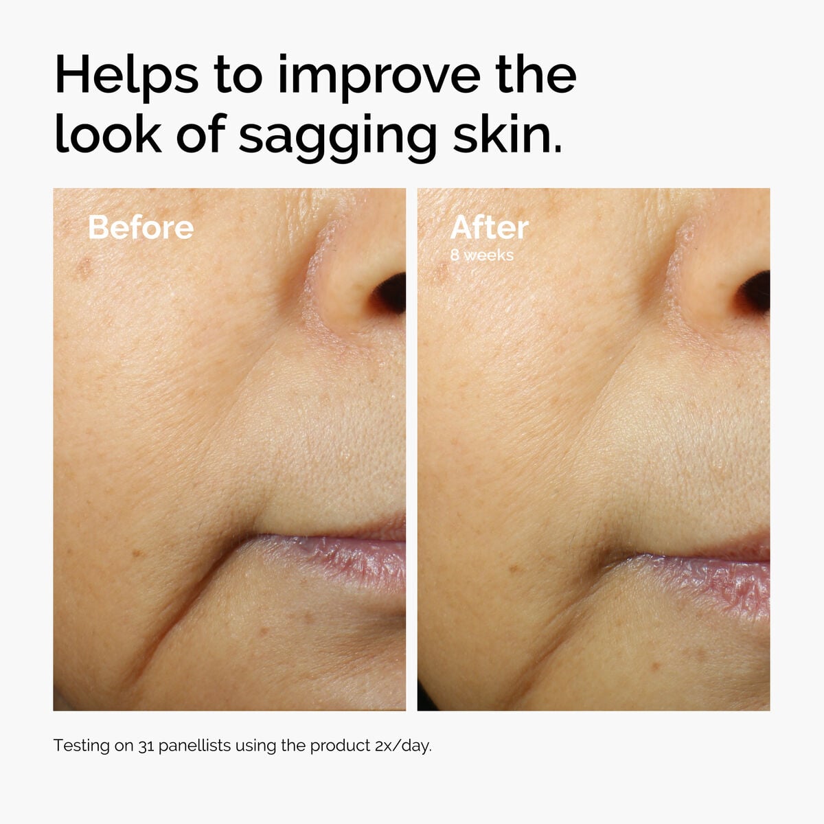 caffeine-3-escin-1-face-serum-x7 ord-caffeine-3pct-escin-1pct-face-serum-before-after-sagging.jpg