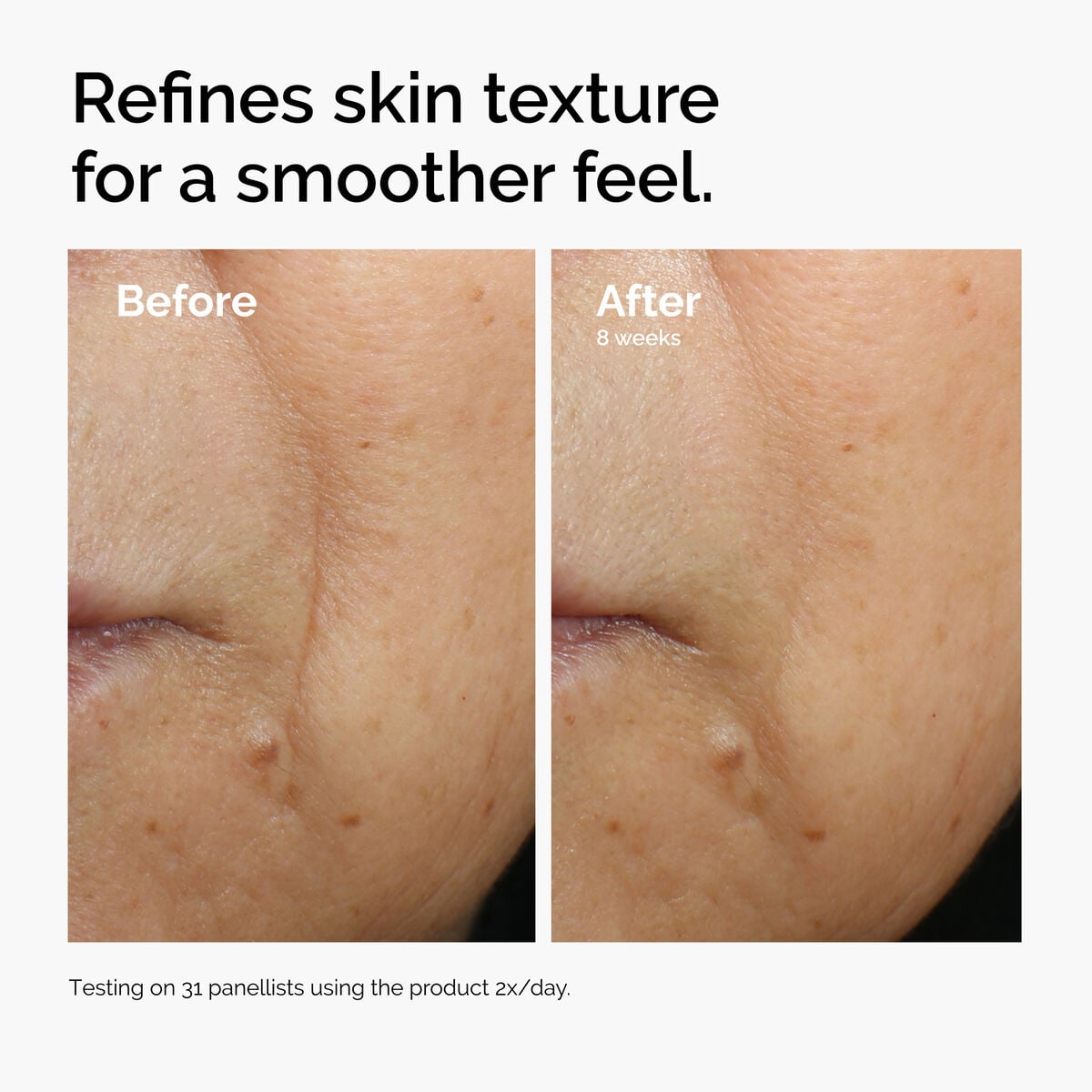 caffeine-3-escin-1-face-serum-x7 ord-caffeine-3pct-escin-1pct-face-serum-before-after-texture.jpg
