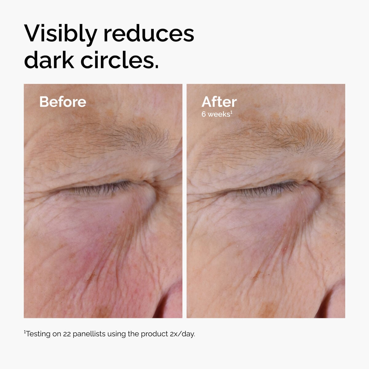 caffeine-solution-5-egcg-eye-serum-h2 ord-caffeine-solution-egcg-dark-circles-before-after.jpg