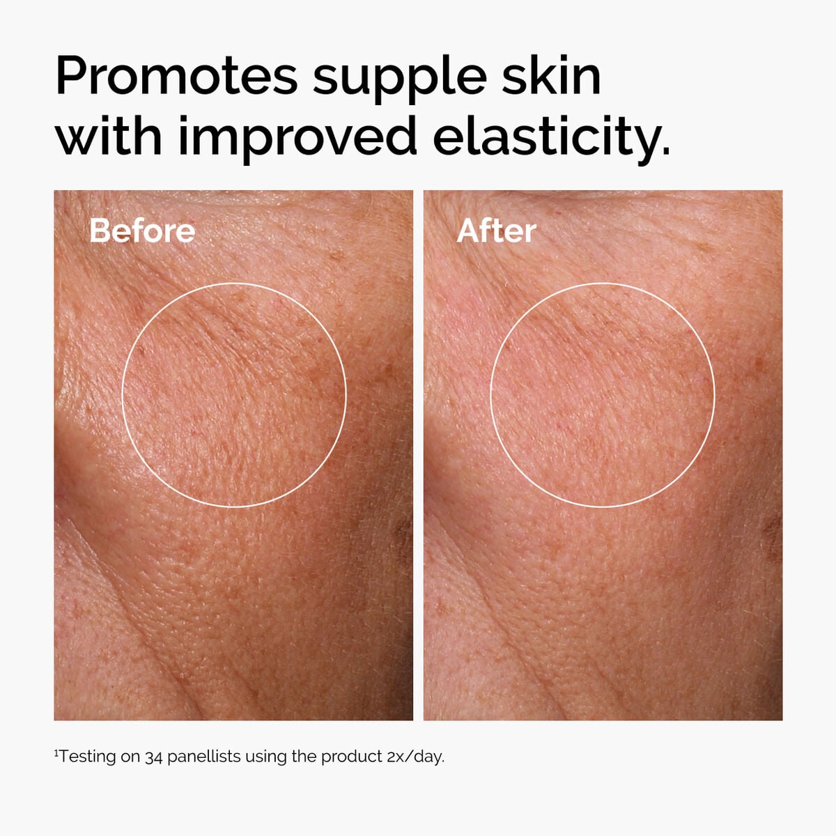 hyaluronic-acid-2-b5-with-ceramides-v0 ord-hyaluronic-acid-2pct-b5-hydrating-serum-before-after-elasticity.jpg