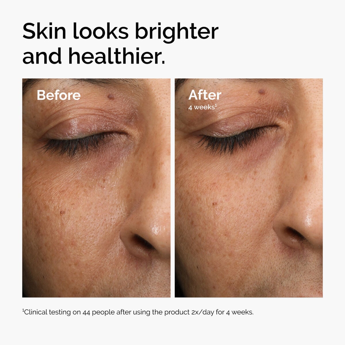 multi-antioxidant-radiance-serum-h3 ord-mars-before-after-healthy.jpg
