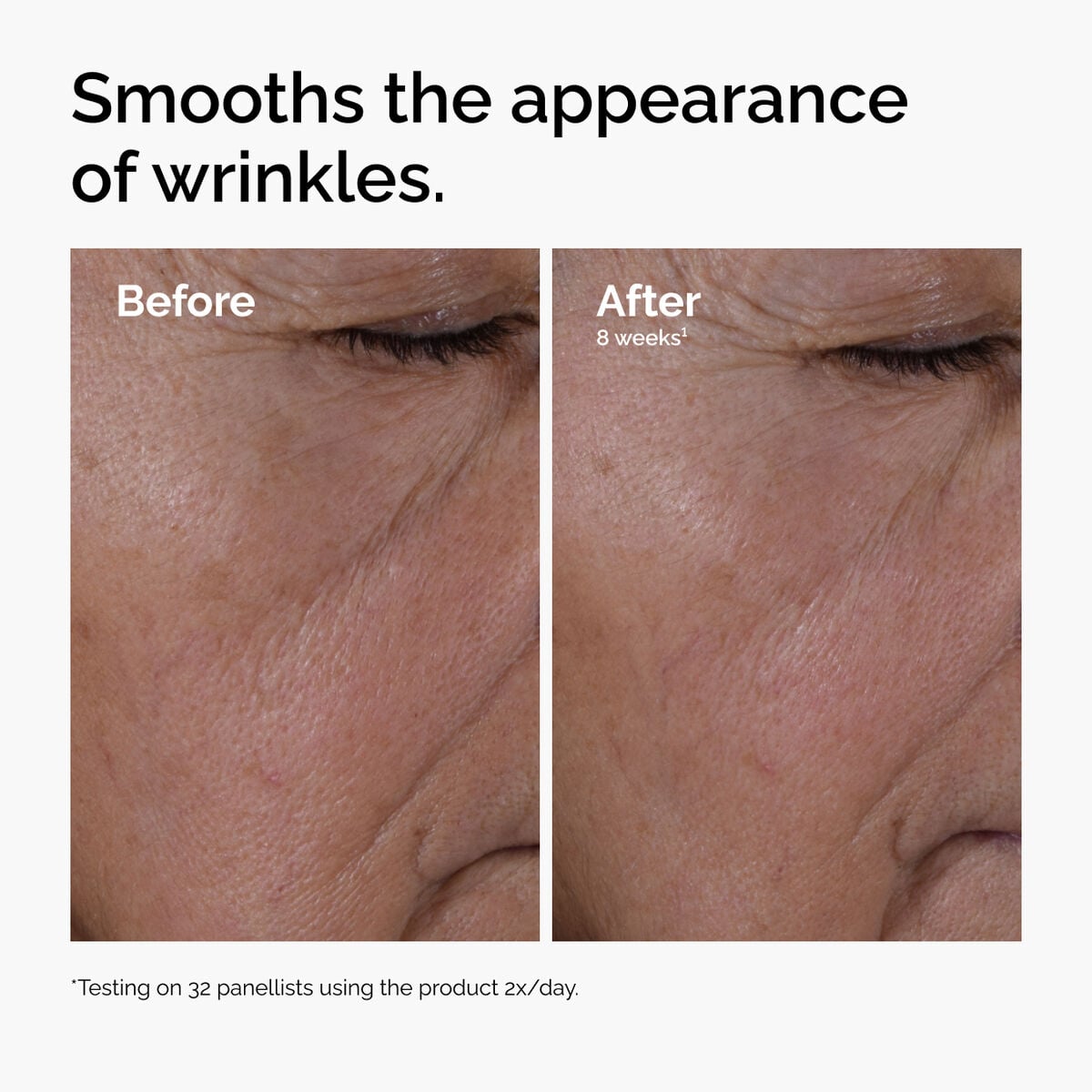 multi-peptide-ha-serum-w3 ord-multi-peptide-ha-serum-wrinkles-before-after.jpg