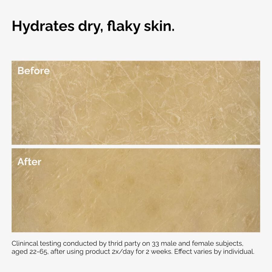 the-body-care-collection-y9 ord-natural-moisturizing-factors-inulin-body-before-after-graphic-02.jpg
