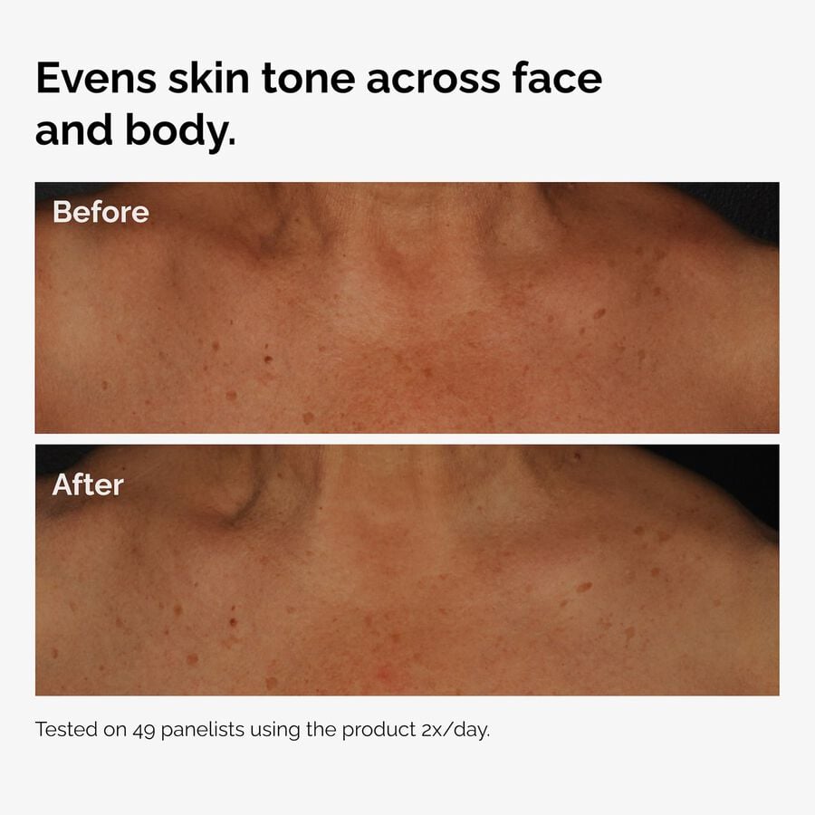 the-body-care-collection-y9 ord-niacinamide-face-body-serum-before-after-even-tone-graphic.jpg