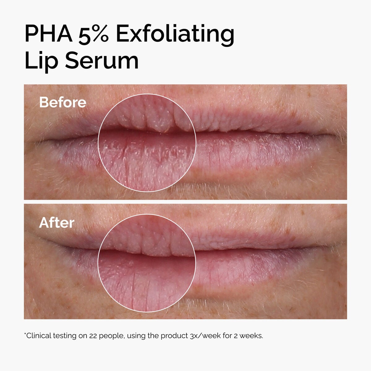 pha-5-exfoliating-lip-serum-q2 ord-pha-5pct-lip-exfoliating-serum-before-after.jpg