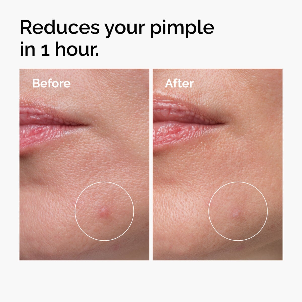 sulfur-10-powder-to-cream-concentrate-g9 ord-sulfur-10pct-powder-to-cream-concentrate-before-after-NA.jpg